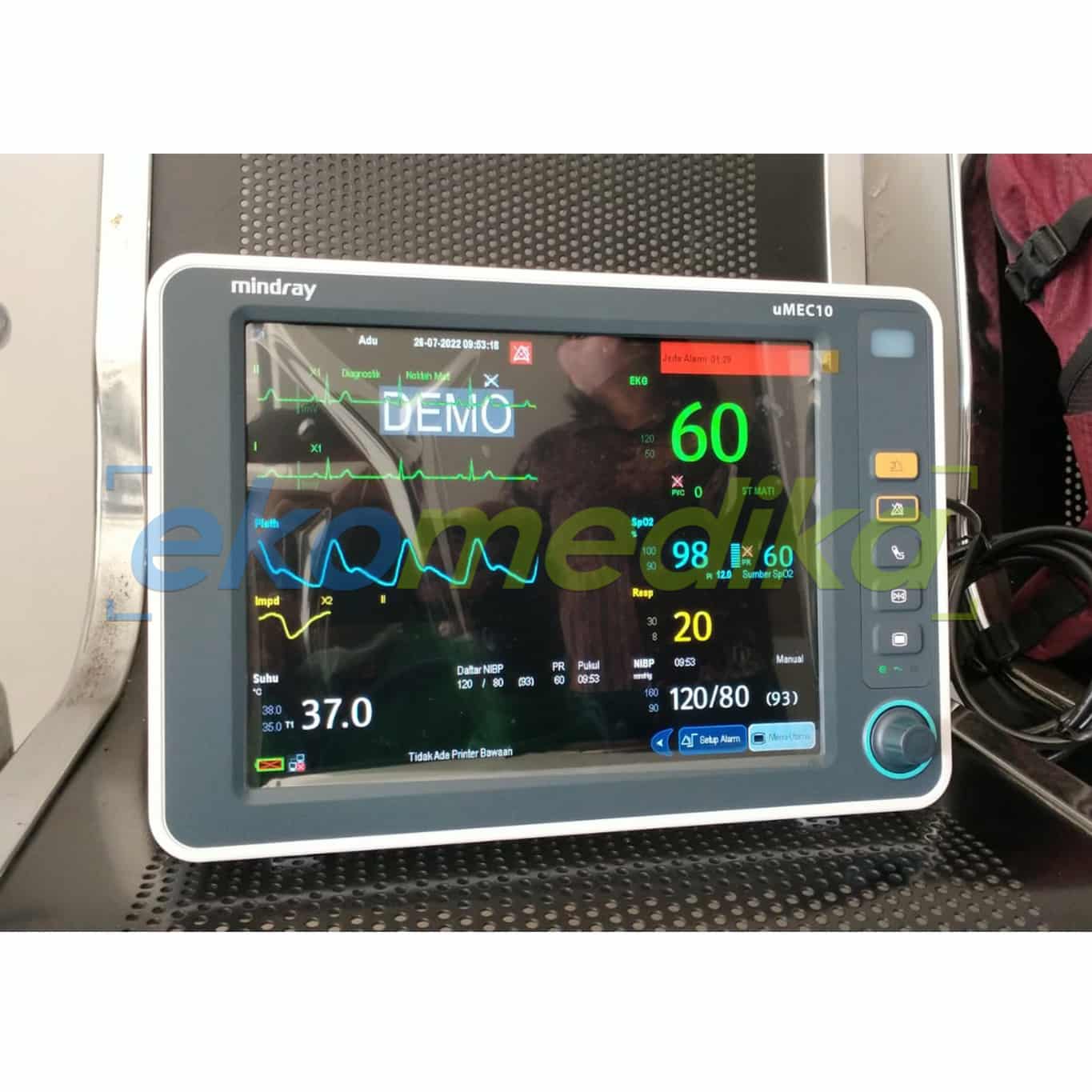 Ekomedika umec 10 patient monitor with printer